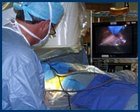 Hyperhidrosis Surgery