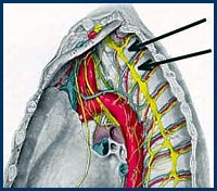 Hyperhidrosis Thorax