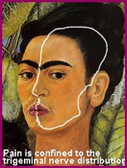 Trigeminal Neuralgia