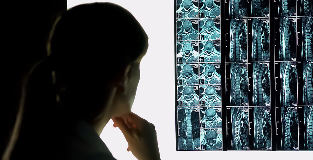 Slide Image of Hospital intern checking patients x-ray, spinal injury diagnostics and treatment
